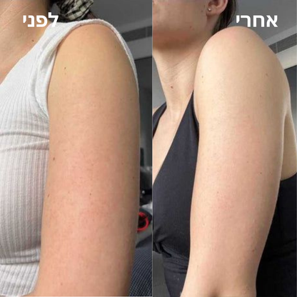 Elovate BareGloss – עור תות