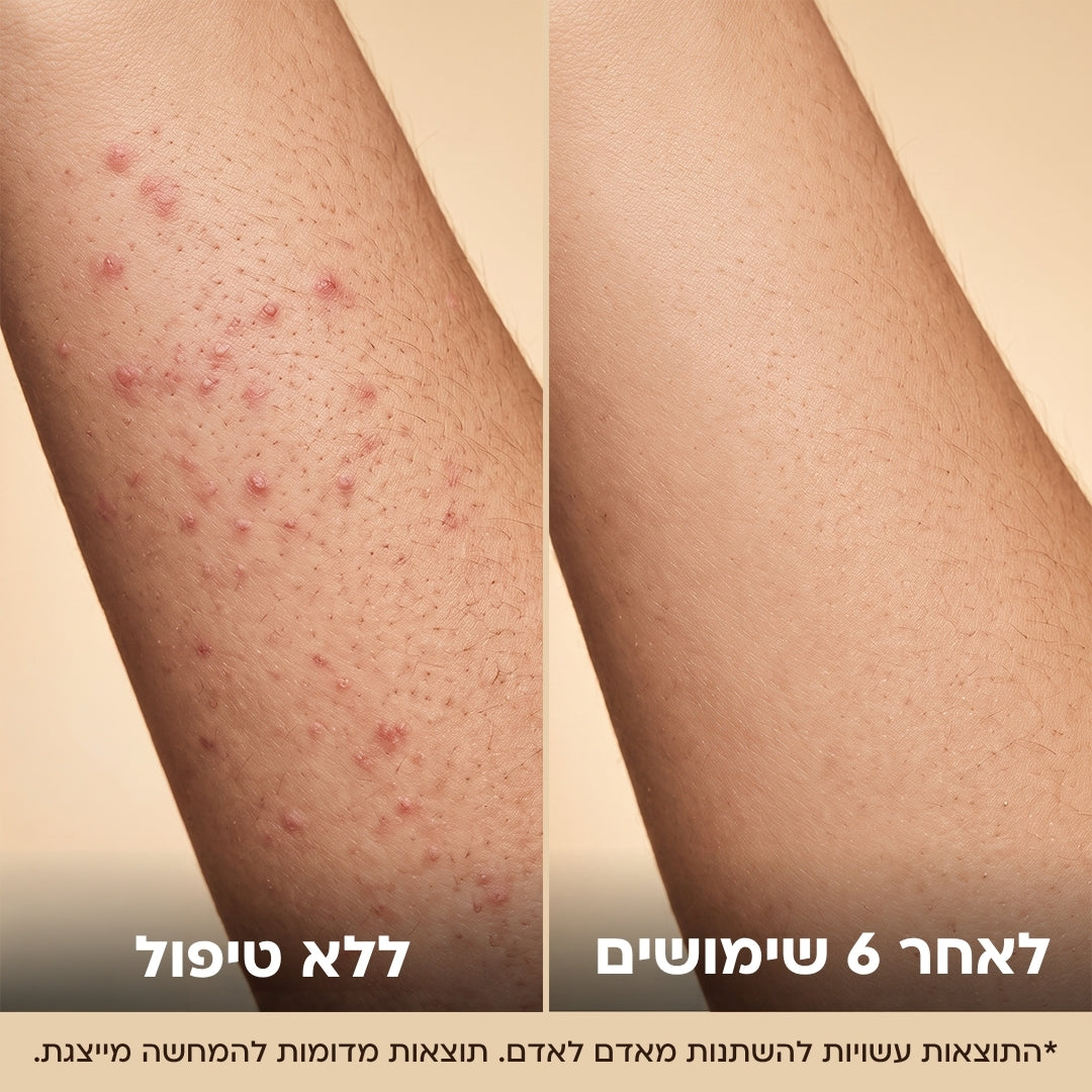 Elovate BareGloss – עור תות