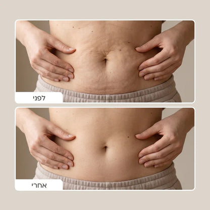 Elovate Bright & Smooth Body Set