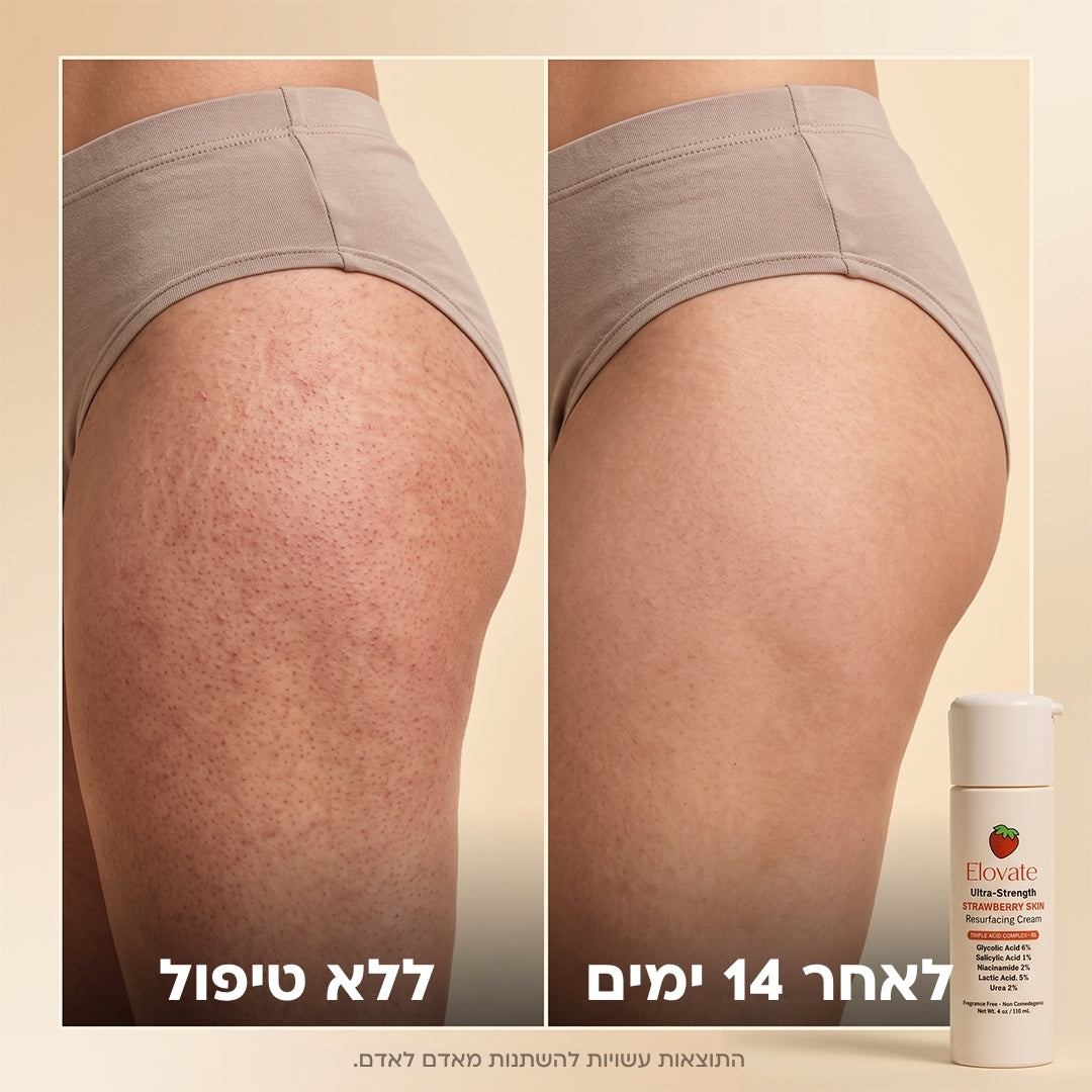 Elovate BareGloss – עור תות