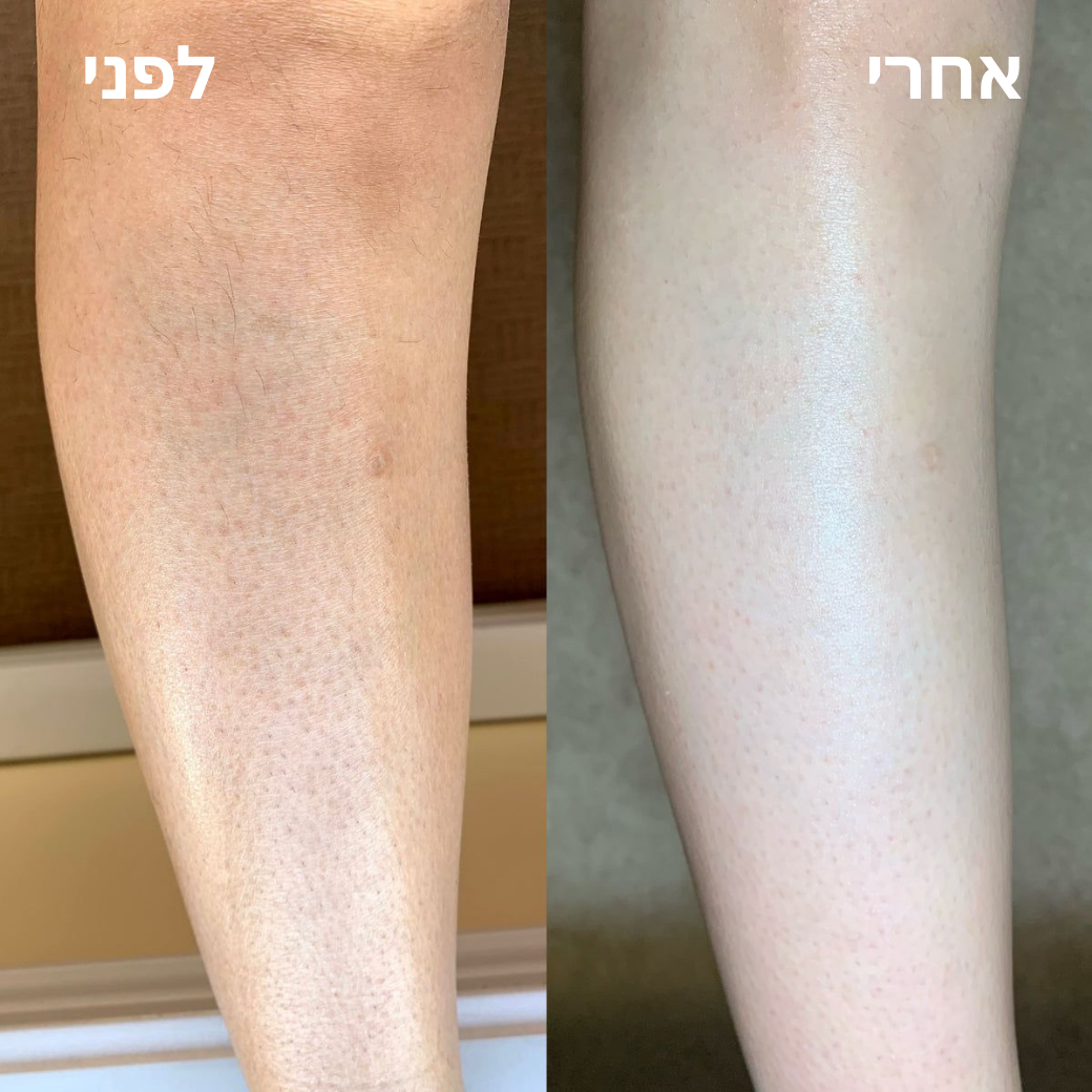 Elovate BareGloss – עור תות