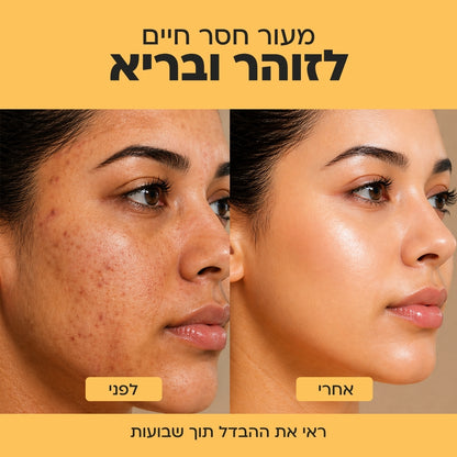 סבון הבהרה וזוהר לעור אחיד Elovate