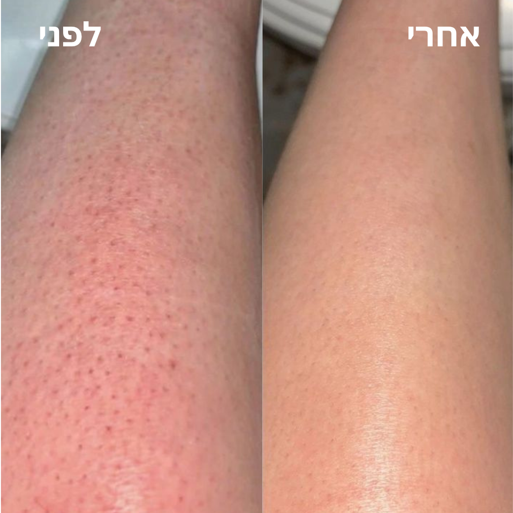 Elovate BareGloss – עור תות