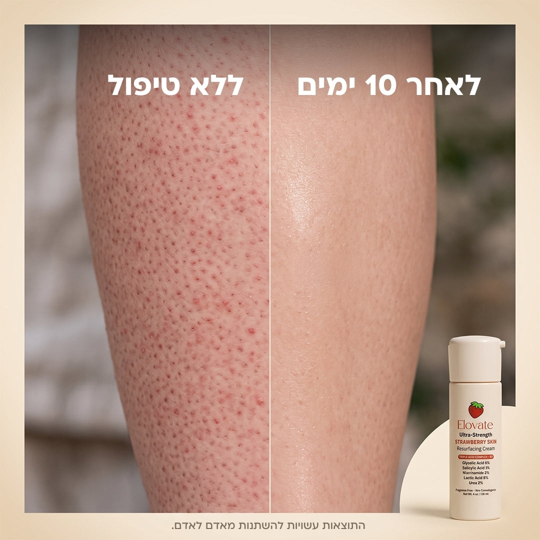 Elovate BareGloss – עור תות