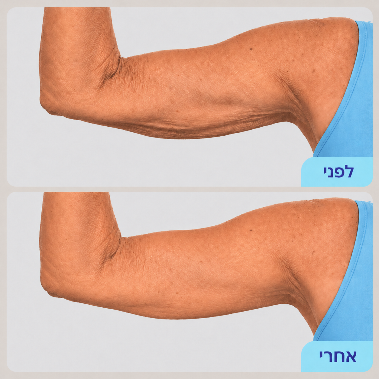 Elovate Bright & Smooth Body Set