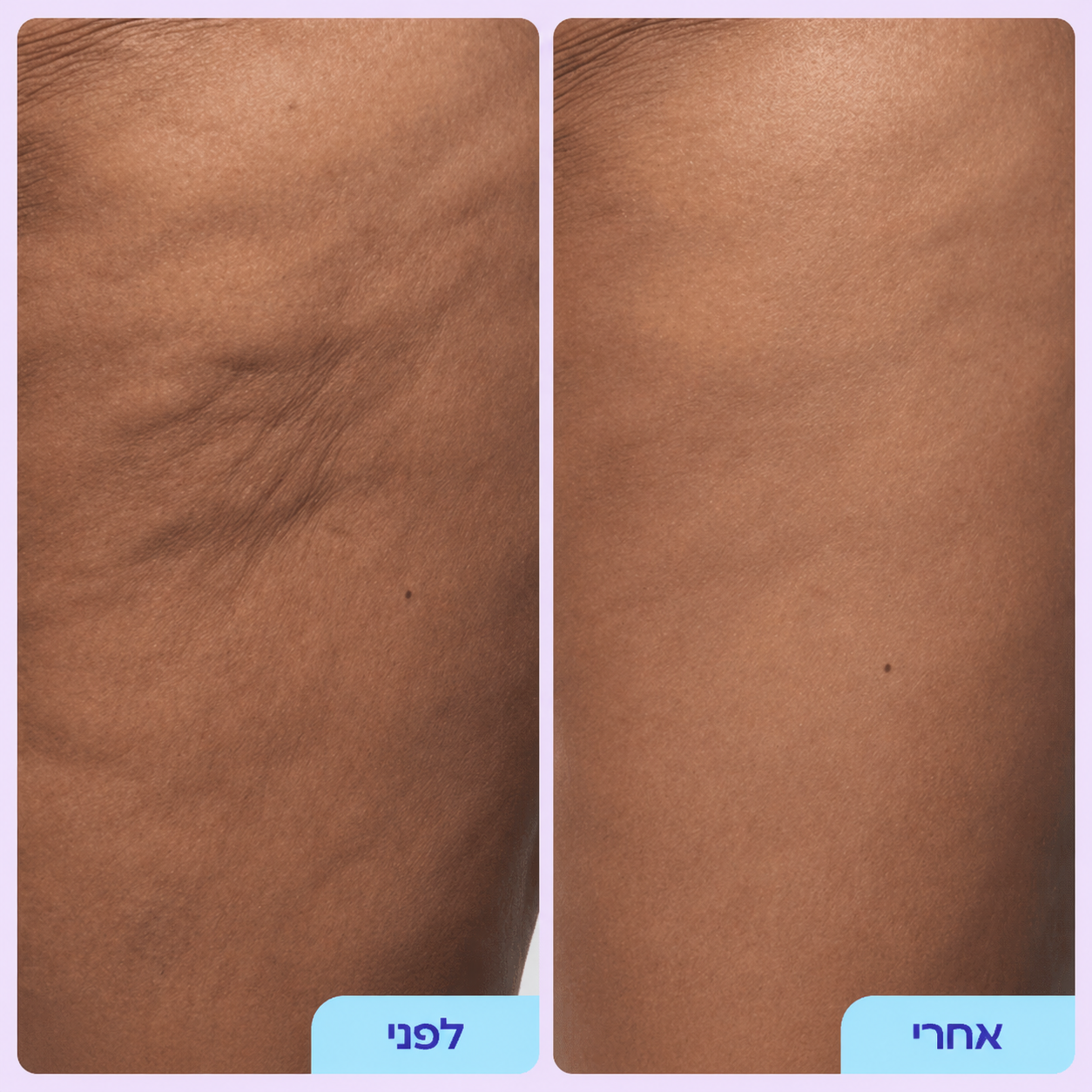 Elovate Bright & Smooth Body Set